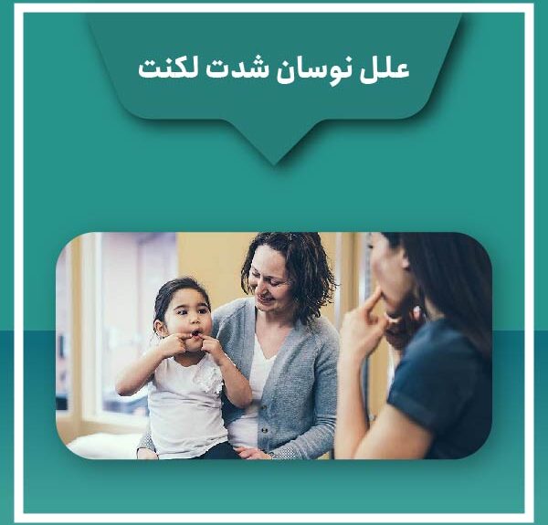Causes fluctuating stuttering intensity علل نوسان شدت لکنت
